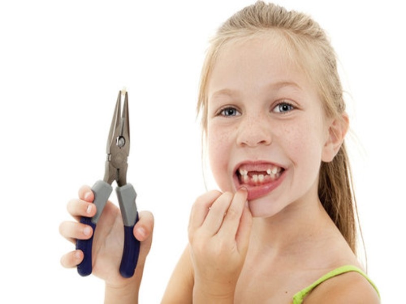 Baby teeth extraction for braces