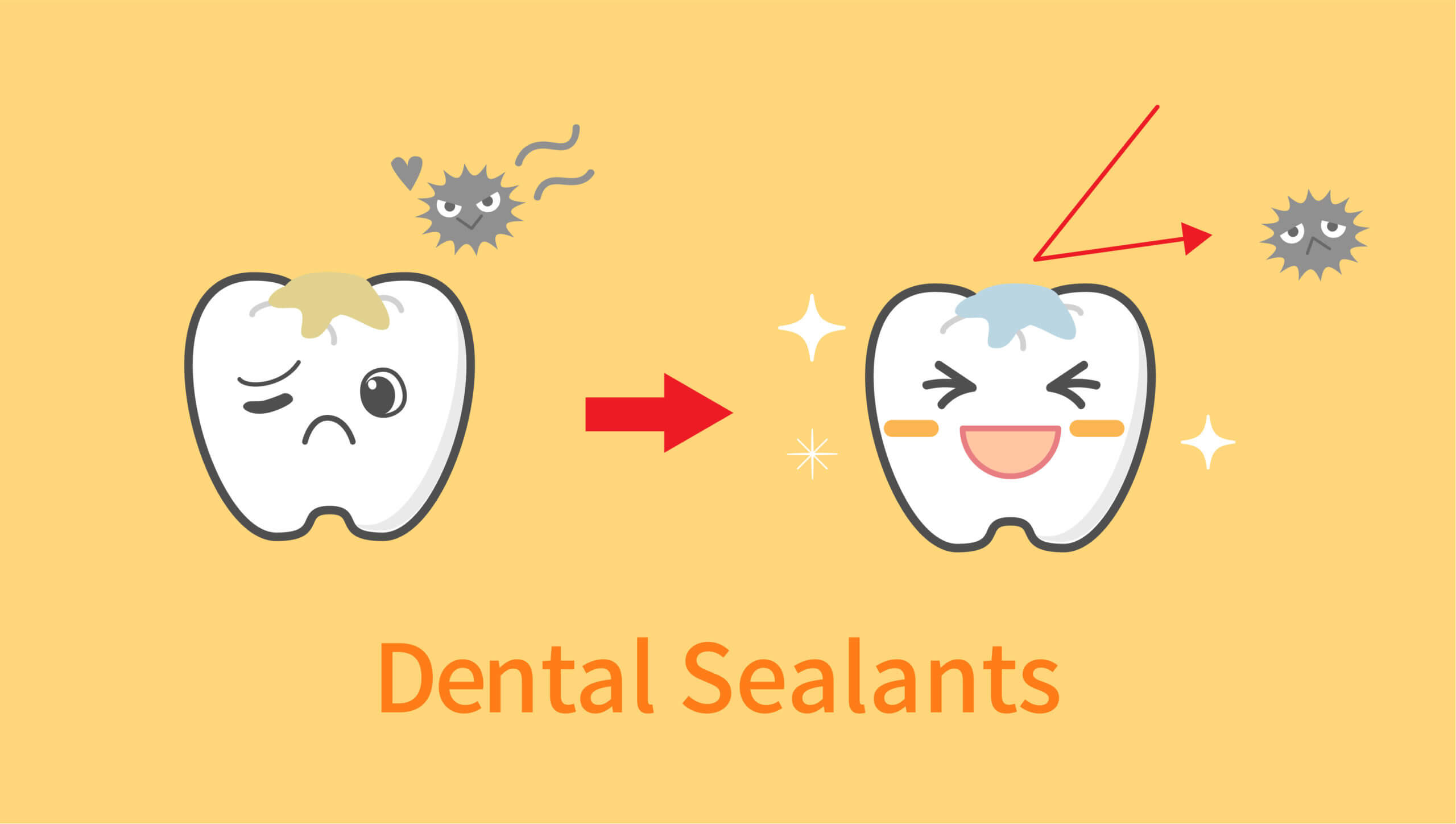 Dental sealants for kids