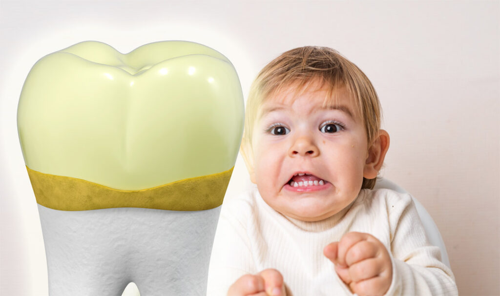 what is dental plaque