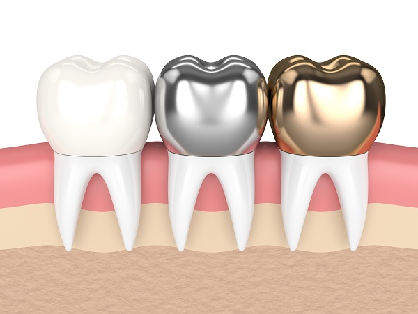 Best Dental Crown for Children