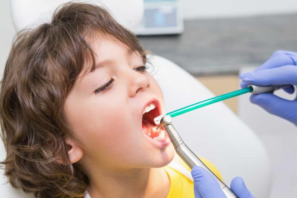 How Often Should Children Visit the Dentist