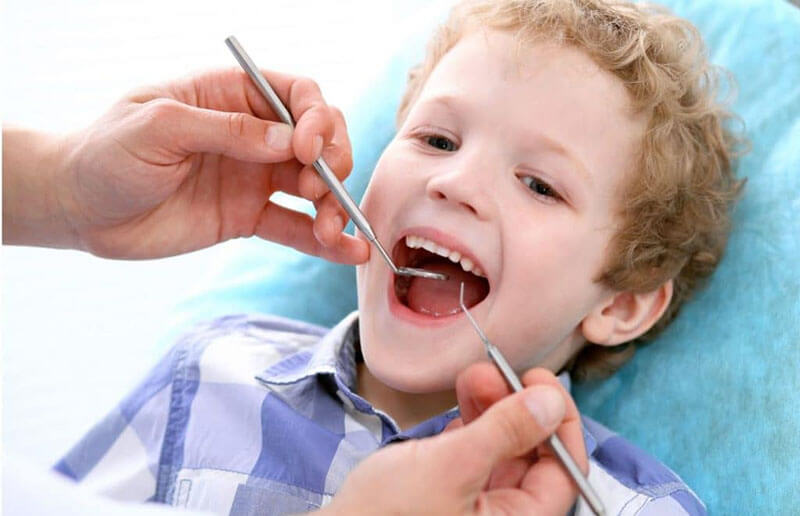 dental sealants for cavity prevention for kids in dubai