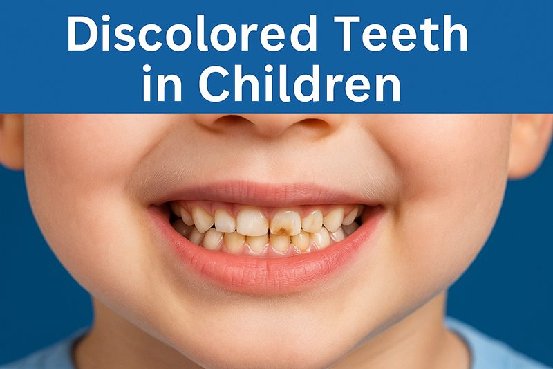 Discolored Teeth in Children in dubai