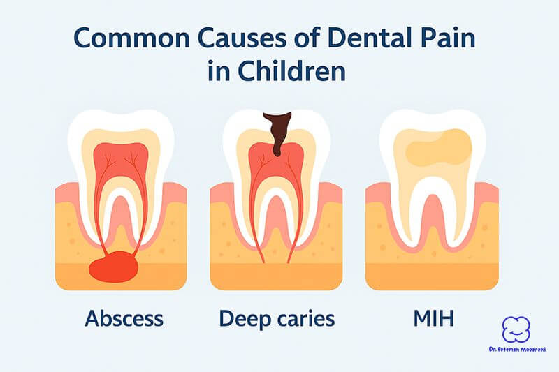 Diagram showing causes of dental pain in children: abscess, deep cavity, and MIH