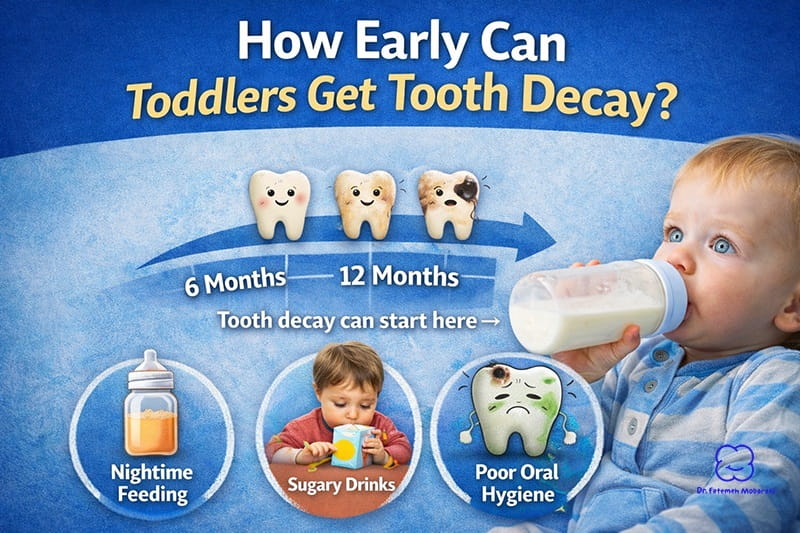 When Does Tooth Decay Start in Toddlers