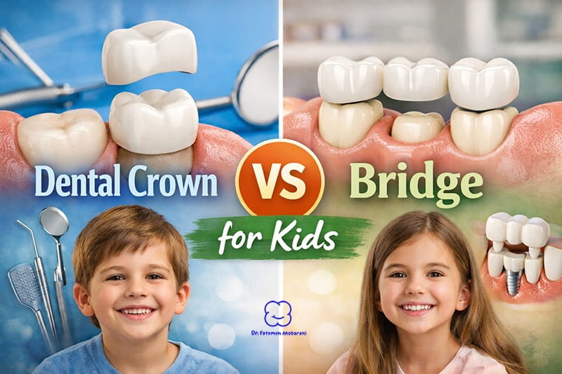 dental crown vs bride for kdis