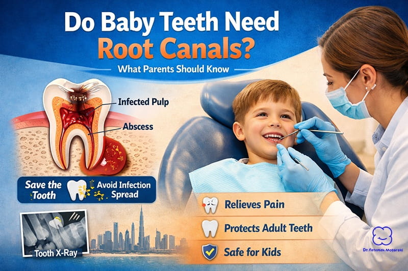 do baby teeth need root canals
