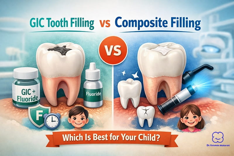 gic tooth filling vs composite filling
