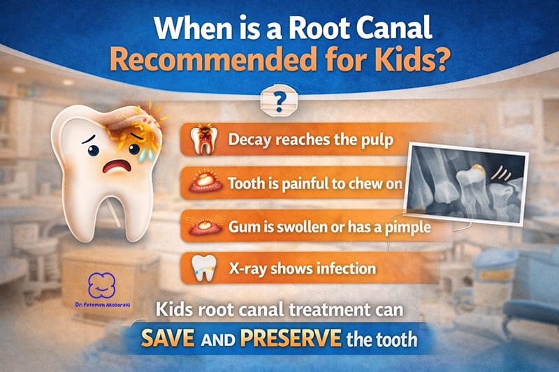 when baby teeth need root canals